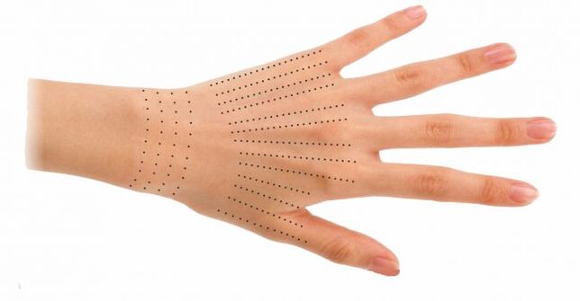Biorevitalizasyon sırasında eller için enjeksiyon bölgeleri